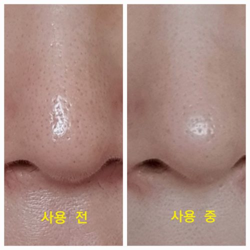 ★선착순 수량한정★ 비밀링크 2주 모공 타이트닝 관리 SET(세럼+패드) photo review